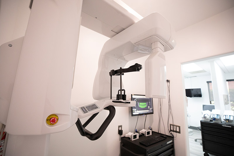 Advanced technology CBCT scanner